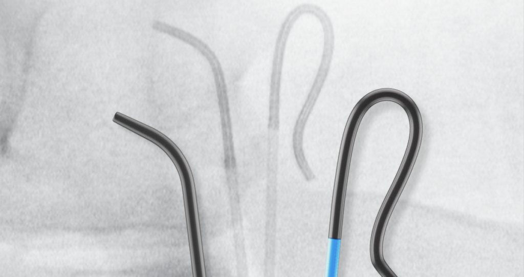 Cook Medical announces Slip-Cath Beacon Tip catheter is now available ...