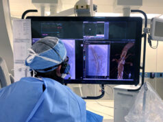 Philips announces LumiGuide 3D imaging technology availability in Europe and USA