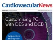 Customising PCI with DES and DCB