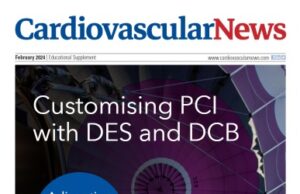 Customising PCI with DES and DCB