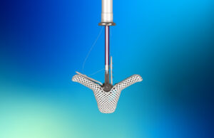 TriClip TEER system for TR repair given US FDA approval