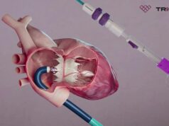 Latest round of funding secured to boost clinical programmes for Topaz tricuspid valve system