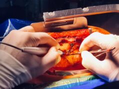 Research aims to understand training needs for left-handed cardiac surgeons