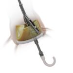 Pi-Cardia_shortcut_comparision_4K_Transparent – Copy1