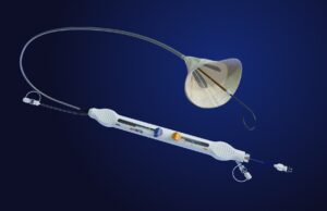 EMBLOK enrols 50th patient in TAVI embolic protection trial