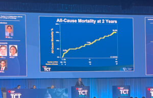 Trilogy valve shows favourable results at two years in aortic regurgitation patients