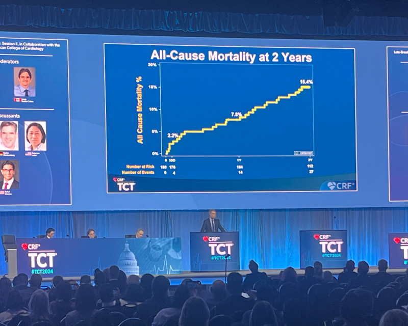 Trilogy valve shows favourable results at two years in aortic ...