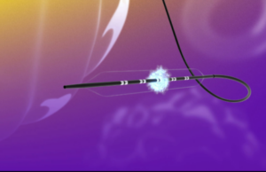 FastWave Medical closes $19 million financing round to advance IVL portfolio