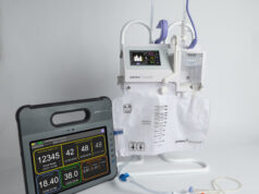 Accuryn monitoring system detects kidney injury in cardiac surgery patients “earlier than standard serum creatine criteria”