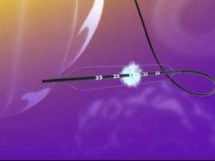 FastWave issued seventh utility patent for its IVL portfolio FastWave