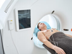 Coronary CT angiography-guided management of stable chest pains shows benefit out to 10 years