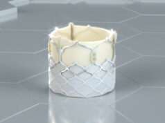 PARADIGM trial of DurAVR TAVI valve gets US FDA green light