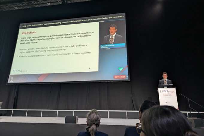 Post-TAVI pacemaker implantation linked to long-term increase in mortality rates