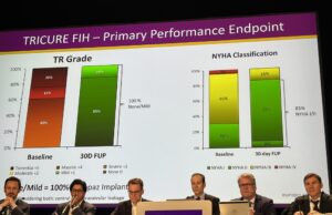EuroPCR 2025 hears early outcomes of Topaz TTVR system