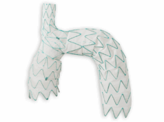 Endospan announces positive 30-day outcomes from TRIOMPHE IDE study TRIOMPHE