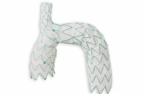 Endospan announces positive 30-day outcomes from TRIOMPHE IDE study TRIOMPHE