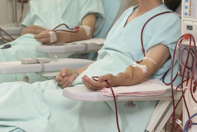 Spironolactone fails to lower cardiovascular risk in dialysis patients