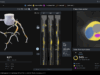 ESC 2026: CT-derived fractional flow reserve helps reduce rates of invasive angiography in stable CAD patients