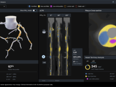 Hearflow’s next-generation Plaque Analysis algorithm gains US FDA clearance