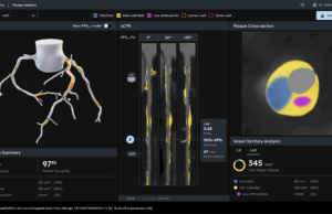 Hearflow’s next-generation Plaque Analysis algorithm gains US FDA clearance