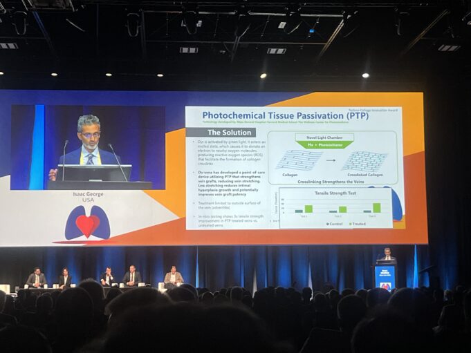 Light-reactive technology offers promise for preventing vein graft failure