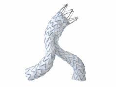 Medtronic’s Endurant receives US FDA labelling approval to remove rAAA treatment warning