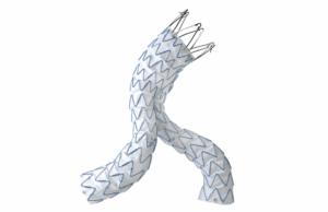 Medtronic’s Endurant receives US FDA labelling approval to remove rAAA treatment warning