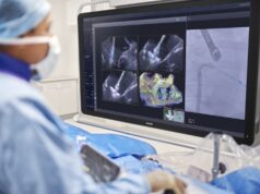 Philips previews AI-powered guidance system for mitral TEER procedures