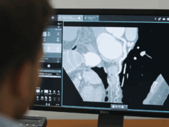 New imaging tool launched to aid coronary interventions