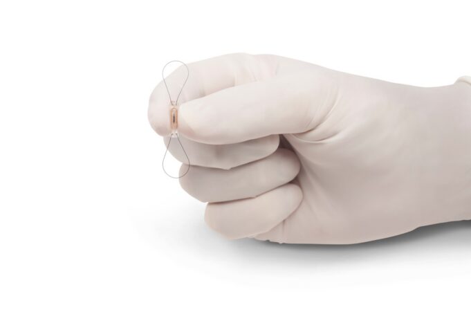 UK’s NICE recommends implantable device for remote heart failure monitoring