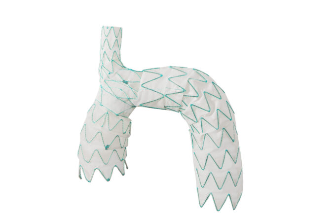 Endospan announces one-year data from TRIOMPHE IDE study TRIOMPHE