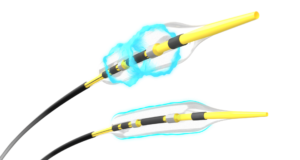 Advertorial: New evidence investigates the impact of Shockwave IVL, Wolverine™ Cutting Balloon and OPN® NC in severely calcified coronary lesions