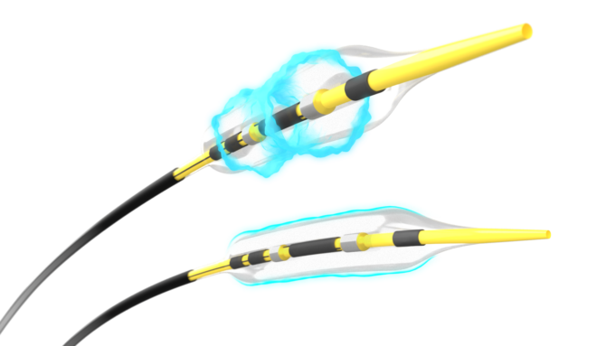 Advertorial: New evidence investigates the impact of Shockwave IVL, Wolverine™ Cutting Balloon and OPN® NC in severely calcified coronary lesions