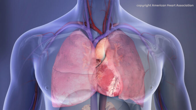 First ACC/AHA acute PE guidelines provide “roadmap” for management
