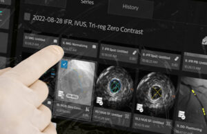 Philips launches latest generation interventional guidance platform