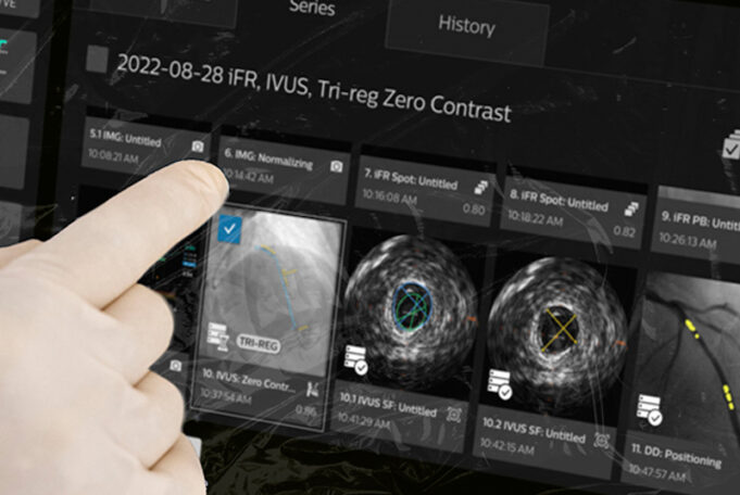 Philips launches latest generation interventional guidance platform