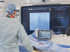 Philips introduces SmartIQ coronary imaging technology