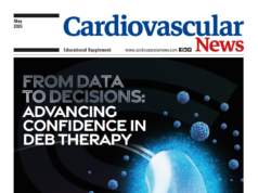 From data to decisions: Advancing confidence in DEB therapy