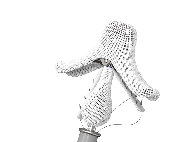 DragonFly TMVr system gains CE mark approval for functional MR indication