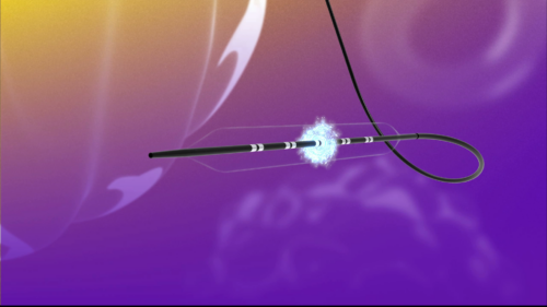 FastWave Medical secures four new international patents