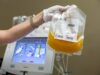 Cold-stored platelets may expand options for addressing bleeding during cardiac surgery