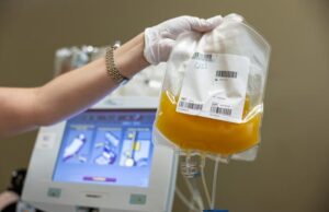 Cold-stored platelets may expand options for addressing bleeding during cardiac surgery