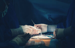 Valve surgery study aims to link randomised trial with real-world data