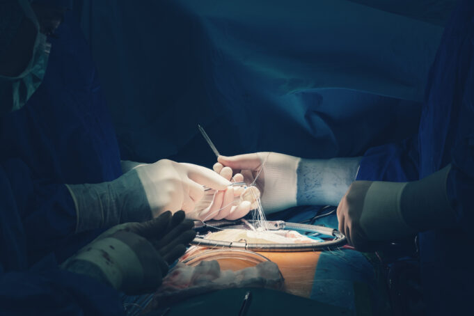 Valve surgery study aims to link randomised trial with real-world data