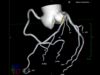 AI cardiovascular diagnostic specialist Elucid completes latest financing round