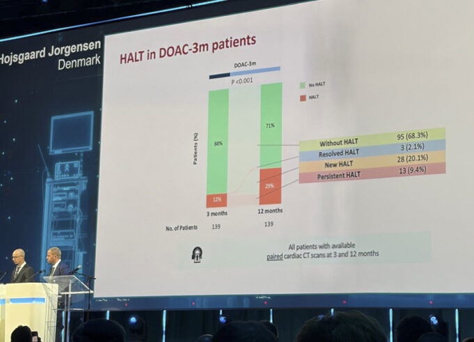 ESC 2026: DOACs only prevent leaflet thickening in the short term after TAVI