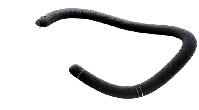 First-in-human implant for TriMemo tricuspid annuloplasty technology