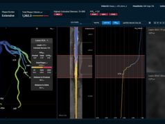 Non-invasive FFR tool gains US FDA clearance