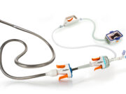 Jupiter Endovascular reveals SPIRARE II results for Vertex thrombectomy system in intermediate-risk PE Jupiter Endovascular